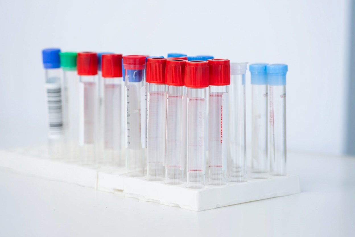 Методы диагностики Пробирки для анализов